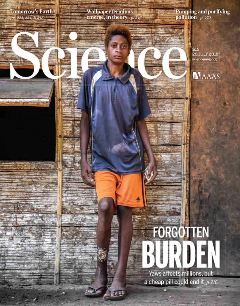 Cover of the journal Science, showing a standing man with an infected leg.
