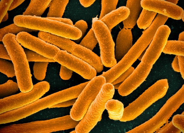 Rod-shaped E. coli bacteria, colorized in orange.